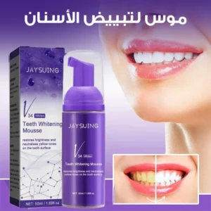 تبييض أسنان الرغوة