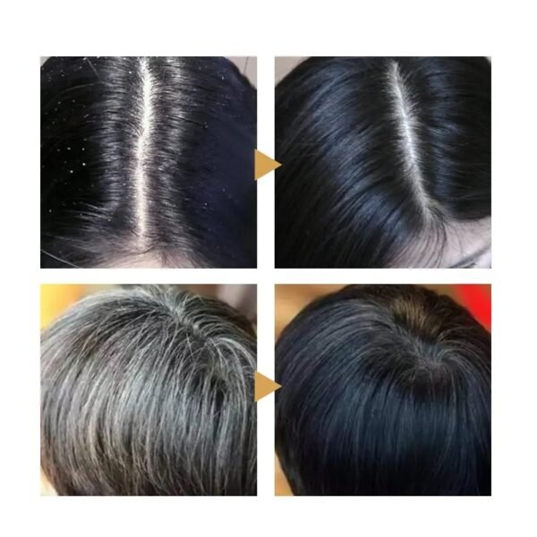 ⁦Black Bright Curing Shampoo⁩ - الصورة ⁦6⁩
