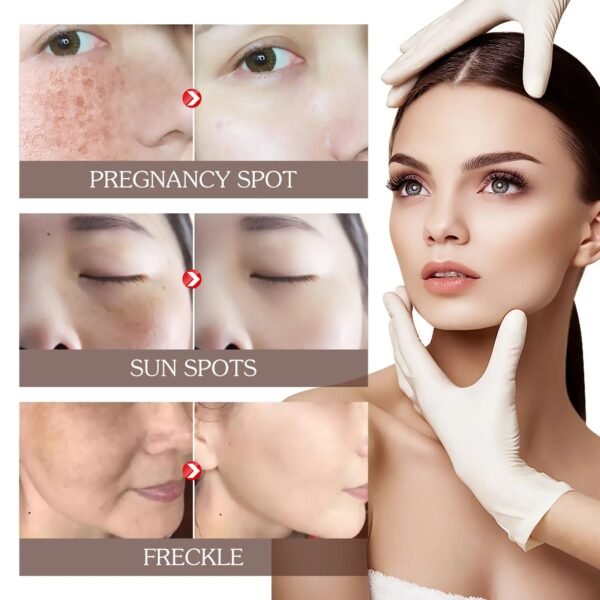 ⁦Face Peeling Mask⁩ - الصورة ⁦11⁩